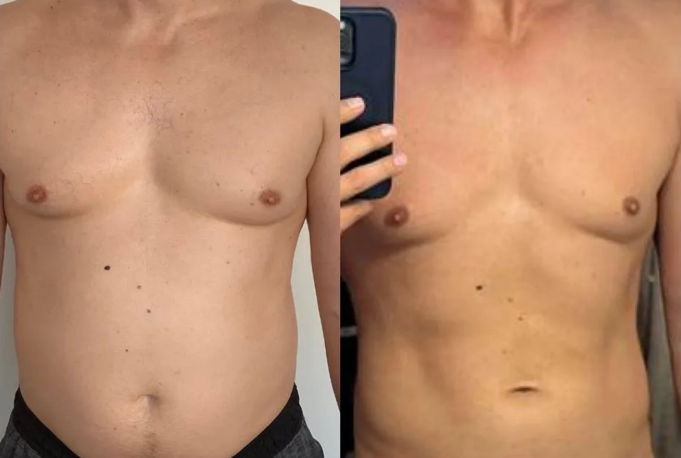 Résultat client — avant et après le programme